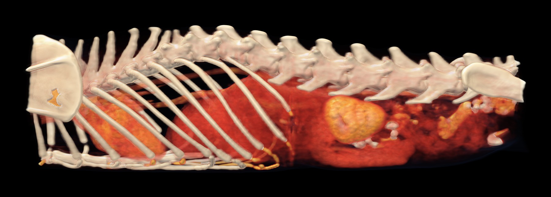3D rekonštrukcia z CT